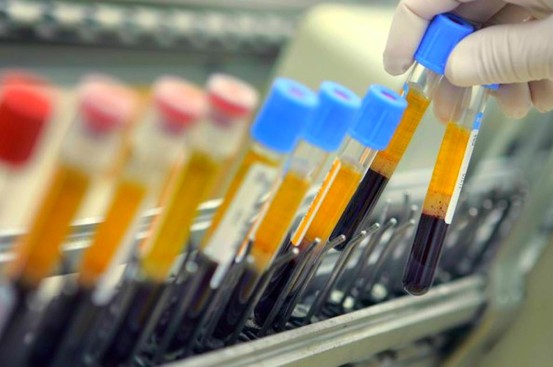 Rio Olympics Antidoping Efforts Faced Serious Issues